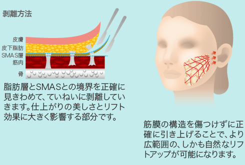 剥離方法