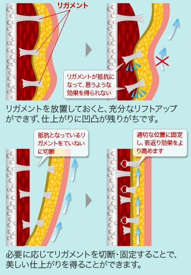 剥離方法