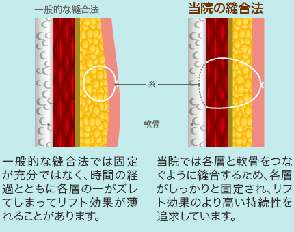 剥離方法